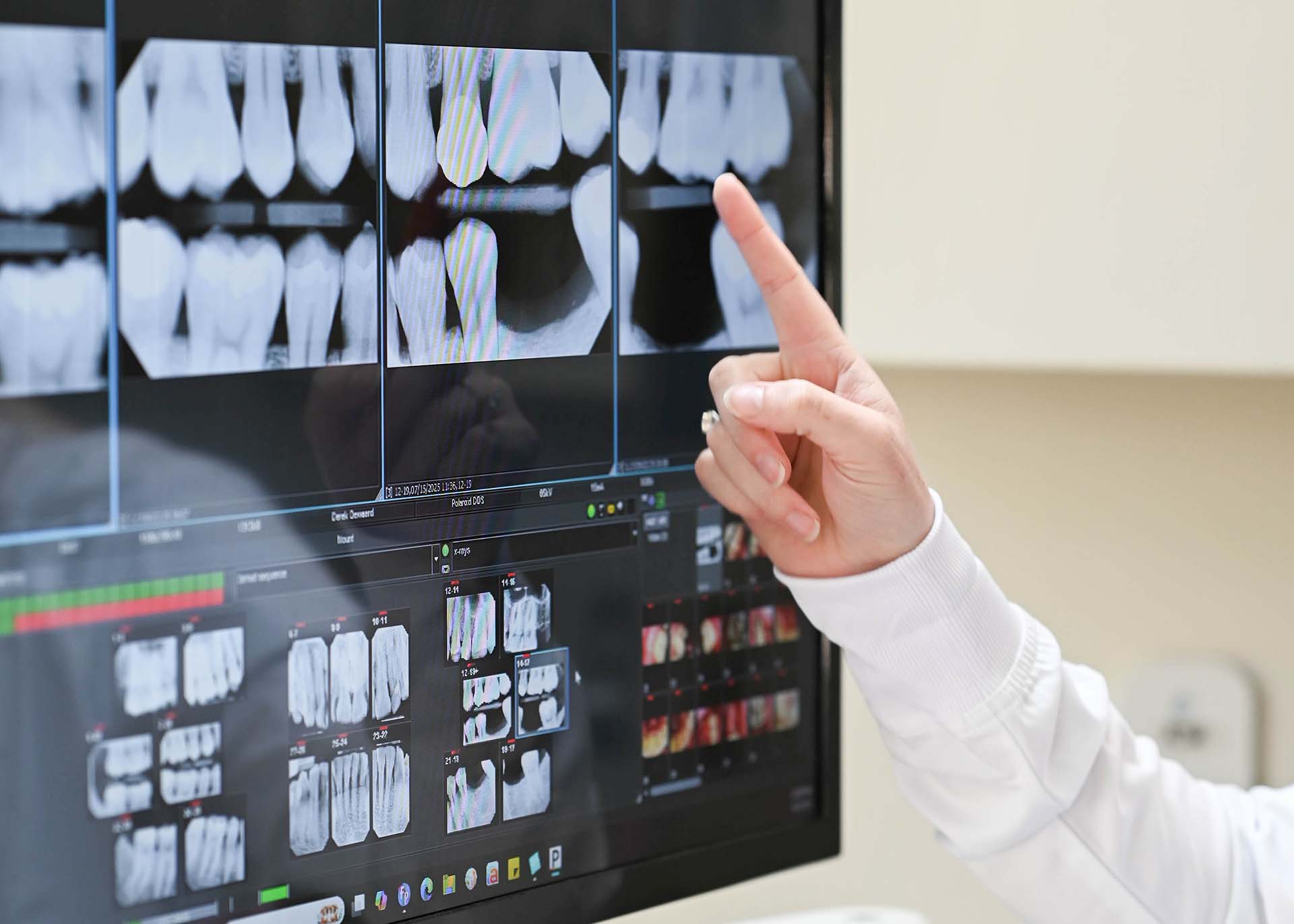 Dental Bridge Dentist Kentwood MI