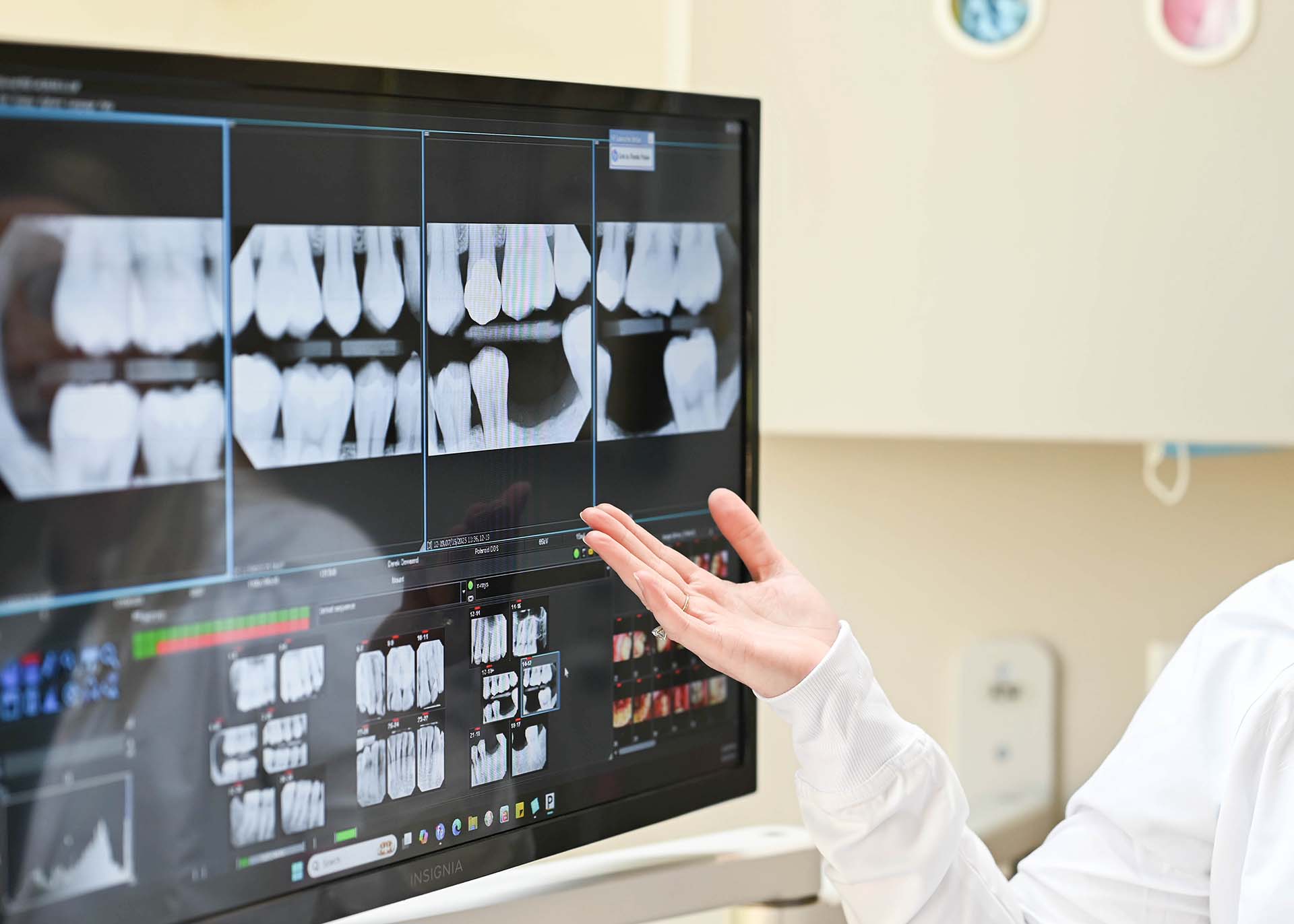 Dental Bridge Dentist Near You