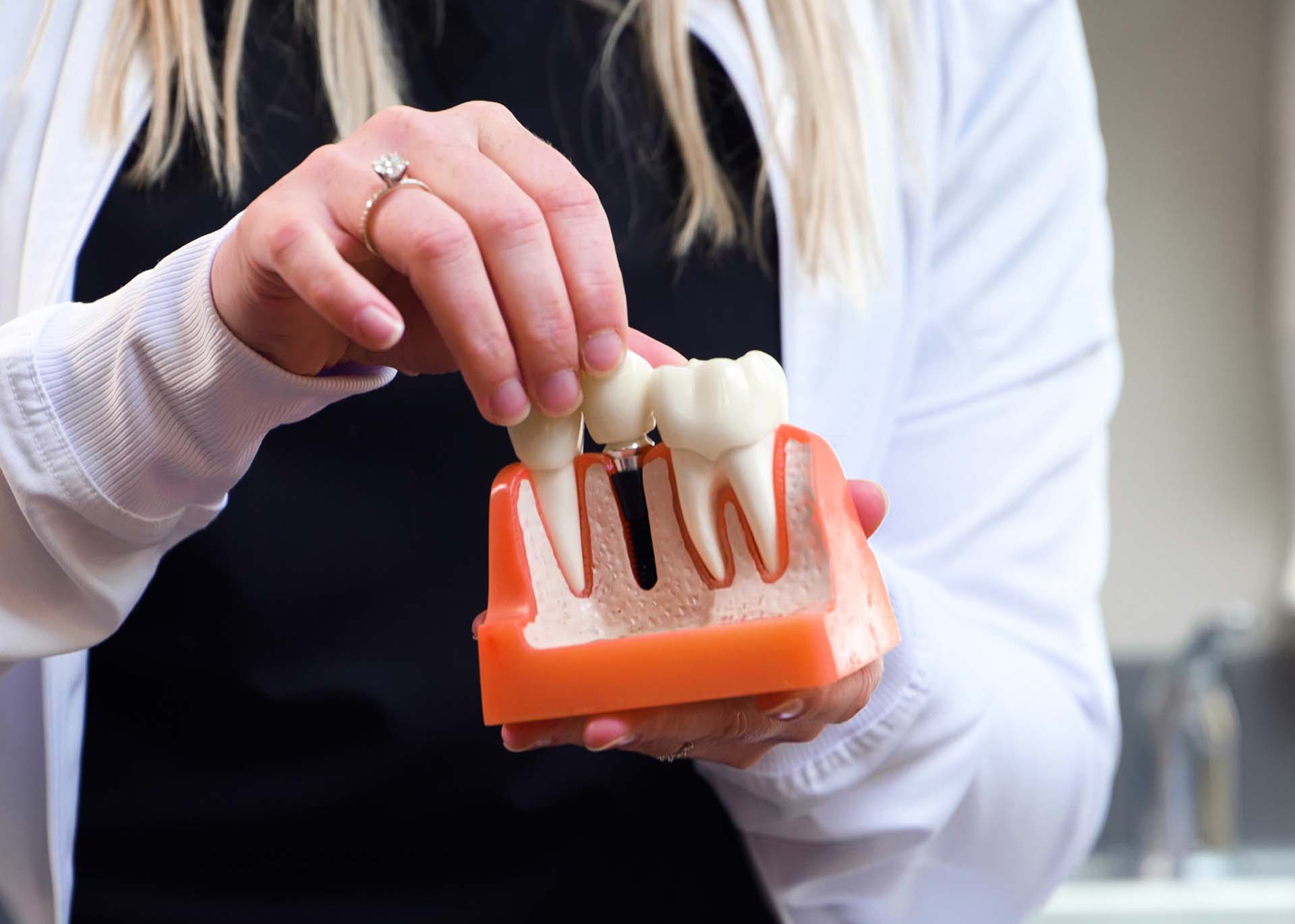 Dental Implant Dentist Near You