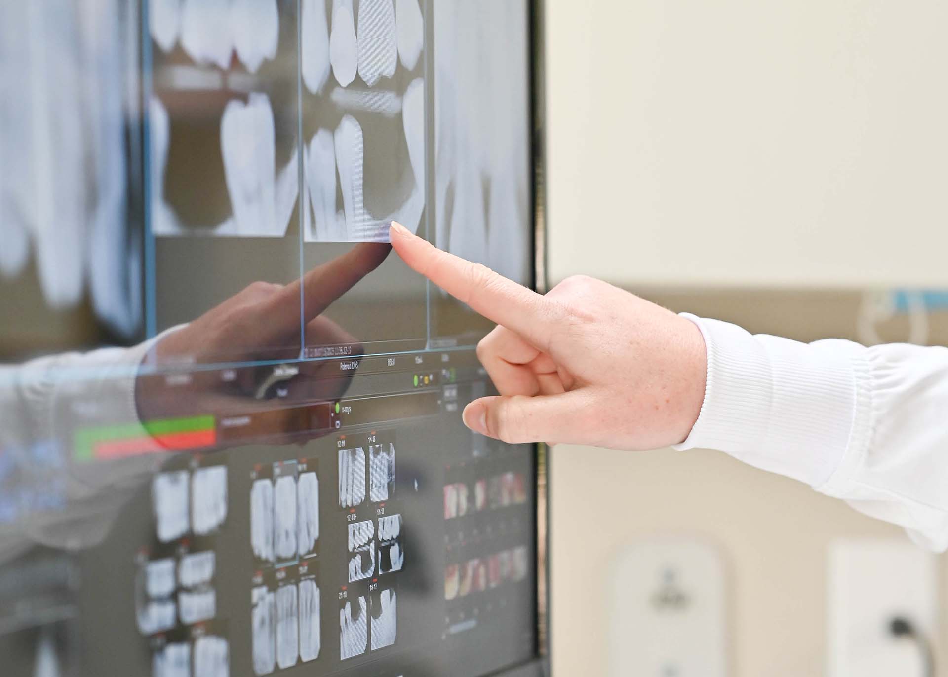 PRF Bone Grafting Dentist Near You