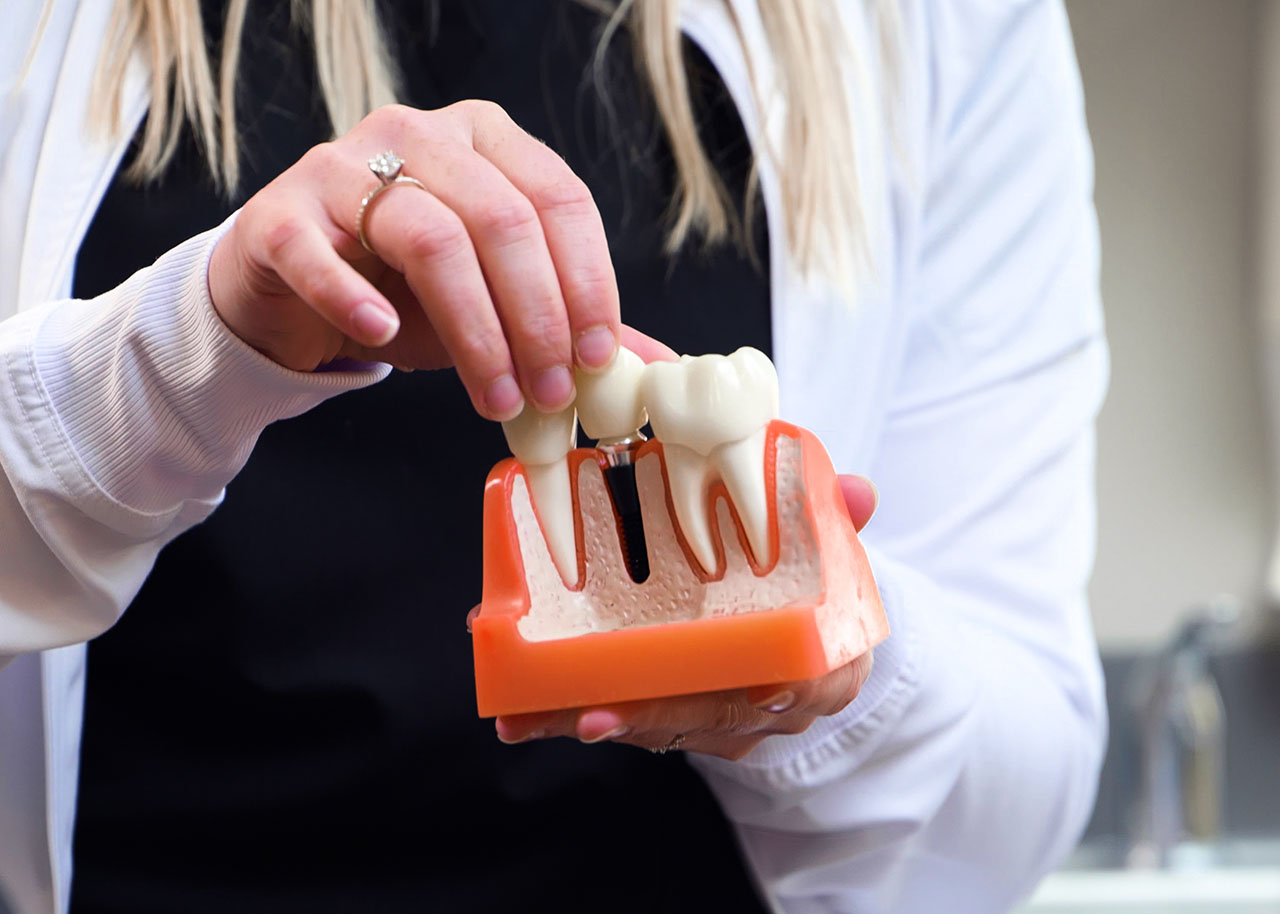 Same-Day Dental Implant Dentist in Kentwood MI